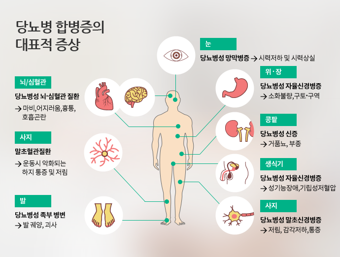 당뇨병 합병증의 대표적 증상